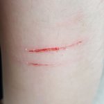 내 <b>손톱</b> 미친건가
