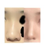 [댓글부탁해] 나 섀딩 전후 쩔지