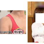 여드름이 생기는 뜻밖의 원인이래