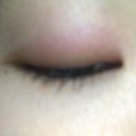 내일 <b>졸사</b> 찍는데 눈이 퉁퉁 부었어