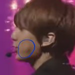 [드루와] 얼굴에 <b>불독</b>?같은거뭐임