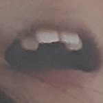 현실) 교정인이 말하는 교정 (웬만하면 하지마)