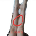 [19] 야 <b>종아리</b>알 어떻게 못없앰????