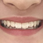 나보다 송곳니 <b>뾰족</b>한애 잇냐