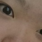 사진ㅇ 쌍수할까 말까 ㅈㄴ고민 돼