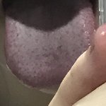 얘들아 나 지금 <b>백태</b> 개오짐