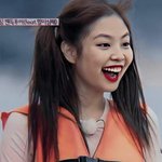 이 <b>보정</b> 안구림,?