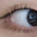 <b>무쌍</b>인데 어때 쌍수 해 말아