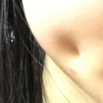 나도 <b>보조개수술</b> 질문받음