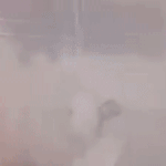 아랫배가 바늘로 찌르는 것 <b>처럼</b> 아픈데
