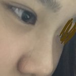 내 코 좀 봐줘 ㄹㅇ 자살하고 싶어