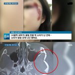 서울역서 <b>대낮</b> 여성 폭행.공분여론,여성들 분노 확산