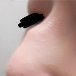 메<b>부리</b>코 나보다 심한사람