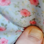 [ㅈㄱㄴ] 극혐)나 <b>발톱</b>이 두개야 어떡해?????