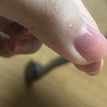 다리에 긴 황금색털 <b>한가닥</b> 자라는데 뭘까 ㄹㅇ;;;