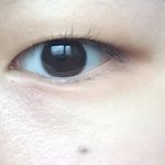 <b>내</b><b>눈</b> 쌍수하면 어떨거같아 봐주러