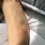 나만 발에 이런 <b>무늬</b> 있냐