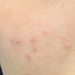 나 피부 <b>재생</b>능력 ㅆㅅㅌㅊ