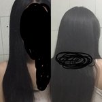 단발병 <b>직빵</b> 치료해드립니다~^^