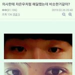 남사친 성형<b>권유</b> 하고싶다