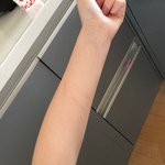 얘들아 이거 ㅈㅎ <b>흉터</b>같아 보여?