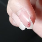 [드루와] 혐 주의) <b>손톱</b> 날라감... 피 남...