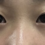 나 <b>꼬막</b><b>눈</b>이야?