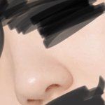 [댓글부탁해] 내코 수술할 정도임? ㅅㅂ