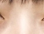 [댓글부탁해] 나 <b>짝눈</b> 많이 심해??ㅠㅠㅠㅠ