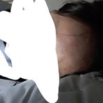 헐 내 태블릿여드름 오지게 잘보여<b>주네</b>