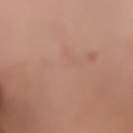 반영구 눈썹 시술을 했는데요ㅠ