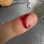 아 나 피가 너무 많이 나