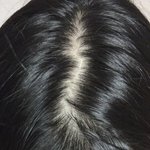 [댓글부탁해] 얘들아 나 <b>탈모</b>있는거야??