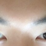 남자 <b>쌍</b>커풀 어떤가요 수술해야할까요(사진)