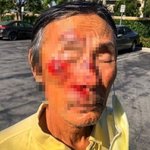 한인 노인 무차별 폭행한 흑인, “중국인 <b>바이러스</b> 싫다”