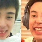 와 진짜 연예인들은 <b>라미네이트</b> 다 하는구나