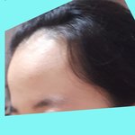 나 <b>이마</b> 넓은데 앞머리 내리기가 너무 싫다;