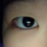 [댓글부탁해] 쌍수 할말??????