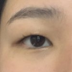 내 눈 이런데 쌍수 할말