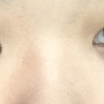 [댓글부탁해] 이런 코는 수술이 답?