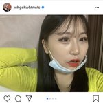 [드루와] 야 <b>조두</b>팔 진짜 많이 이뻐지지 않음?