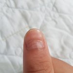 <b>손톱모양</b>이이상해요.