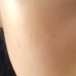 나 피부 평가해줘,,