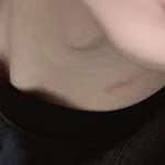 이거 키스<b>마크</b>같아??