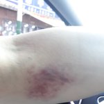 [<b>의료</b>사고] 이거 <b>의료</b>사고에 해당하는 건가요?