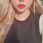 입술 <b>필러</b> 4일차얌