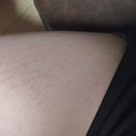 [댓글부탁해] 얘들아 나 튼살<b>심각</b>해ㅠㅠ (혐주의)