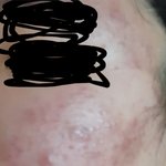 나 피부어떡해..ㅠㅠㅠㅠㅠㅠ