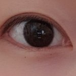[댓글부탁해] <b>쌍수</b>절개했는데 쌍커풀사라짐