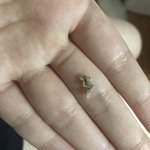 19년 묵은 배꼽때 팜(짤 더러움)